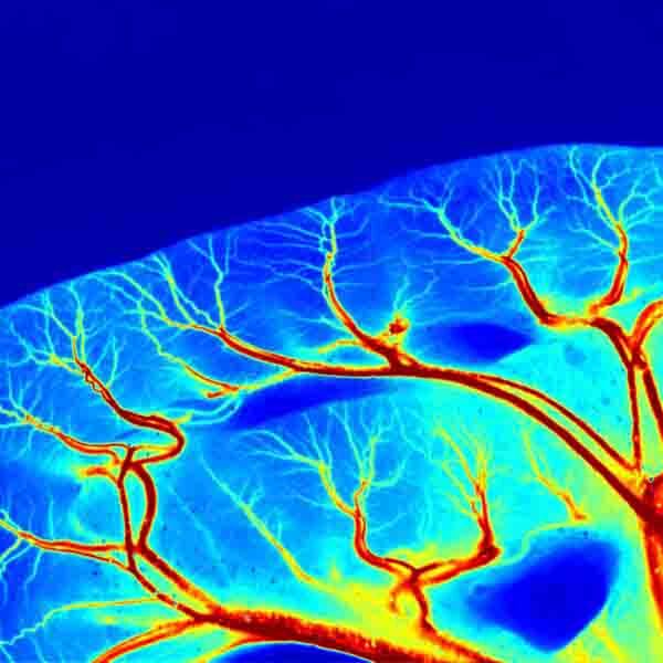 Лазерная спекл-контрастная система визуализации RFLSI-ZW