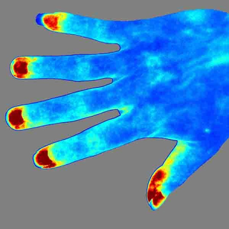 Лазерная спекл-контрастная система визуализации RFLSI-ZW